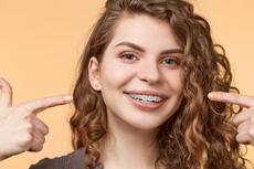 Νέα Σιδεράκια στα Δόντια: Πώς να Διατηρήσετε την Οδοντική Υγεία σας