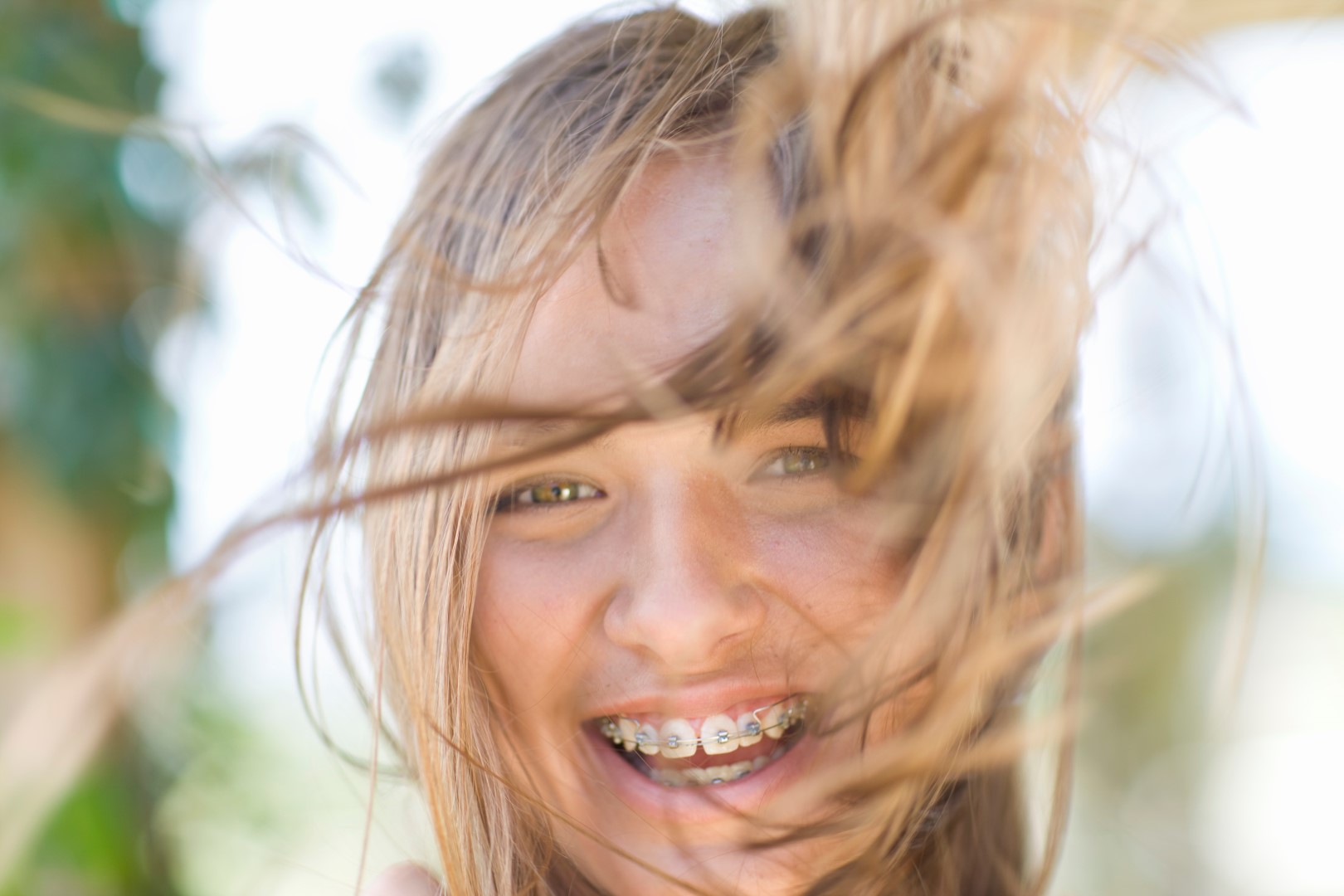 Σιδεράκια ή Διαφανείς Νάρθηκες (Invisalign) -Τι να Επιλέξω για το Παιδί Μου;