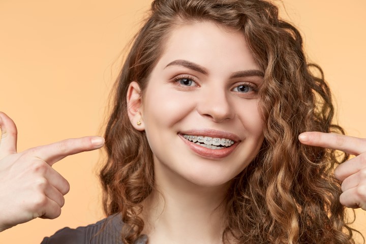 Νέα Σιδεράκια στα Δόντια: Πώς να Διατηρήσετε την Οδοντική Υγεία σας