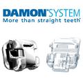 Damon System - More that straight teeth